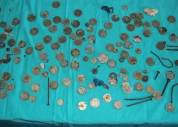 Midesinden 83 TL madeni para çıktı