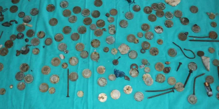 Midesinden 83 TL madeni para çıktı