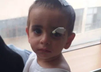 Köpeklerin saldırısına uğrayan çocuk hayatını kaybetti