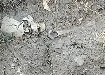 Yağmur suyunun aşındırdığı toprakta iskelet çıktı
