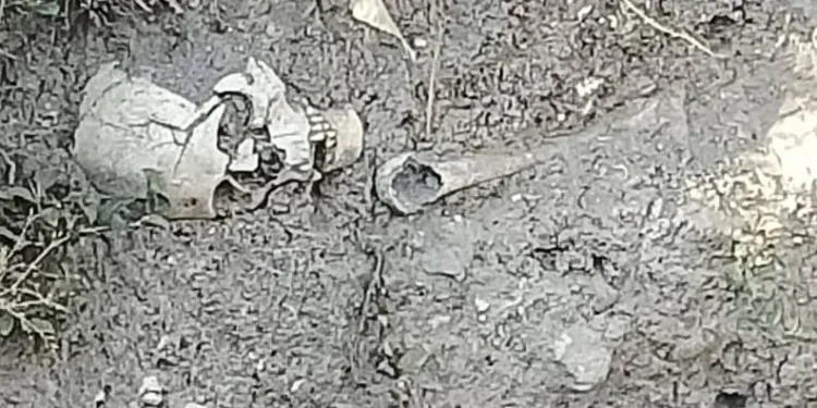 Yağmur suyunun aşındırdığı toprakta iskelet çıktı