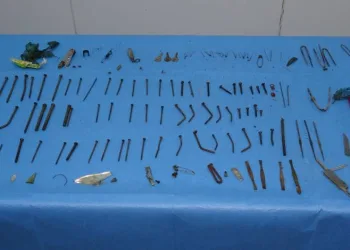 Midesinden 158 parça metal çıktı