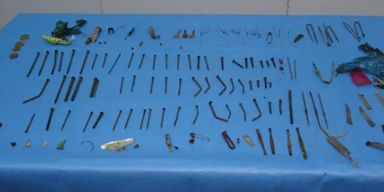 Midesinden 158 parça metal çıktı