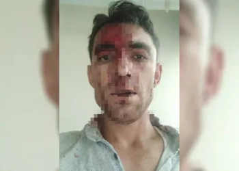 Nevşehir’de komşu dehşeti