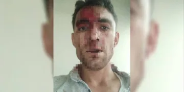 Nevşehir’de komşu dehşeti