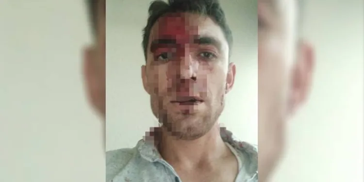 Nevşehir’de komşu dehşeti