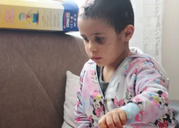 Pitbull saldırısına uğrayan Asiye’nin görüntüleri tepki topladı
