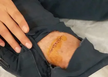 Sağlık çalışanına makasla saldırdı