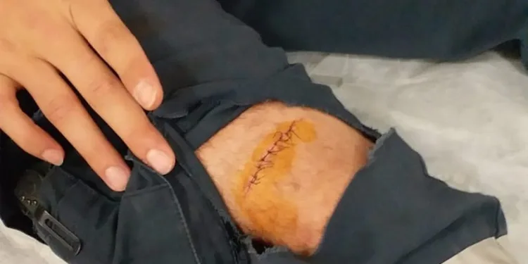 Sağlık çalışanına makasla saldırdı