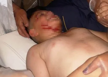 Konya’da köpeğin ısırdığı çocuk hastanelik oldu