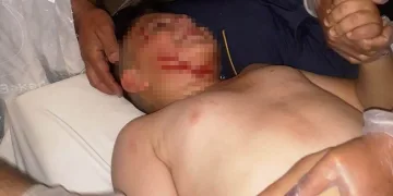 Konya’da köpeğin ısırdığı çocuk hastanelik oldu