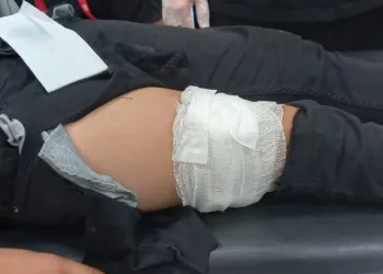 Şanlıurfa’da oyun oynarken ayağına kurşun isabet etti