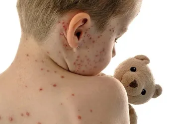 Yeni salgın alarmı: Domates gribi