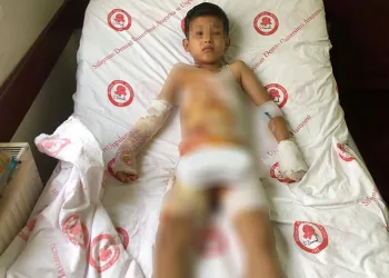 Isparta’da anaokulunda çocuğun üzerine sıcak su döküldü
