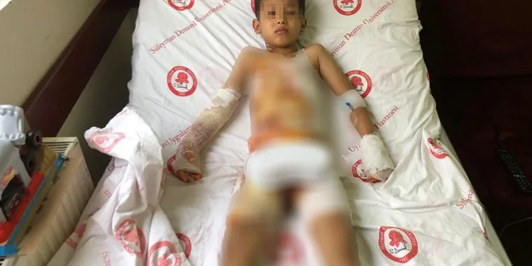 Isparta’da anaokulunda çocuğun üzerine sıcak su döküldü