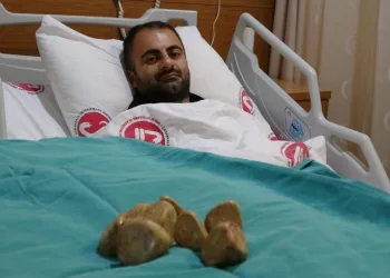 Mesanesinden 550 gram taş çıkarıldı
