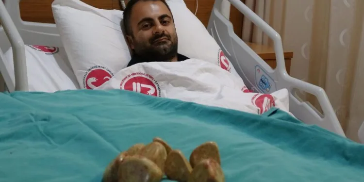 Mesanesinden 550 gram taş çıkarıldı
