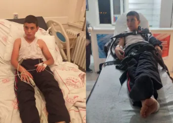 Kuduz teşhisi konulan çocuk hayatını kaybetti