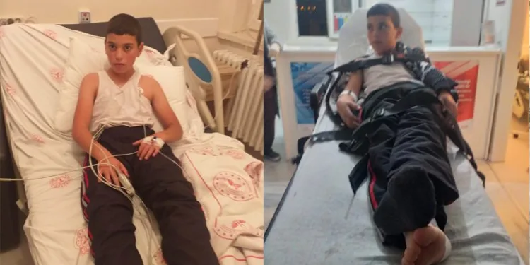 Kuduz teşhisi konulan çocuk hayatını kaybetti
