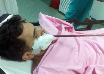 Samsun’da yüzüne saplanan demirle hastaneye kaldırıldı