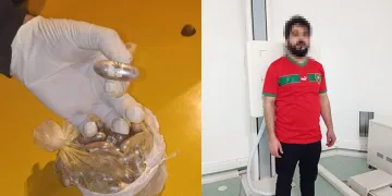 Midesinden 1,5 kilo uyşturucu çıktı