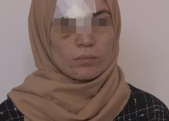 4 yıldır eşinden şiddet gören kadın hastanelik oldu