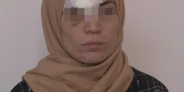 4 yıldır eşinden şiddet gören kadın hastanelik oldu