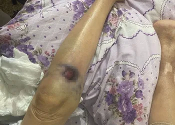 Yaşlı kadın bakıcısı tarafından darp edildi iddiası