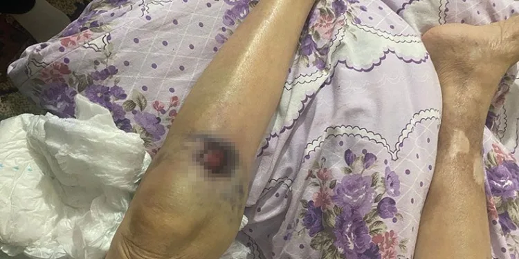 Yaşlı kadın bakıcısı tarafından darp edildi iddiası