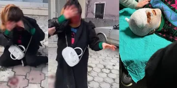 Barışma teklifini reddedince hastanelik oldu