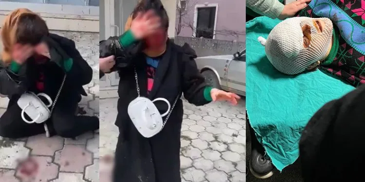 Barışma teklifini reddedince hastanelik oldu