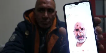 Sinek ısırığıyıla hayatının şokunu yaşadı