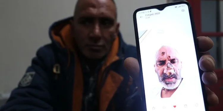 Sinek ısırığıyıla hayatının şokunu yaşadı