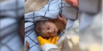 Avucunda annesinin saçları ile enkazdan çıkarıldı
