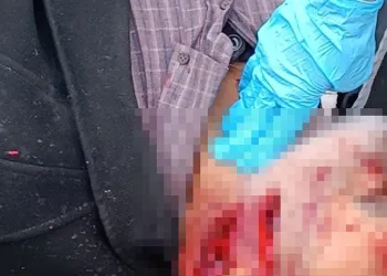 Tartıştığı babasına tahrayla saldırdı