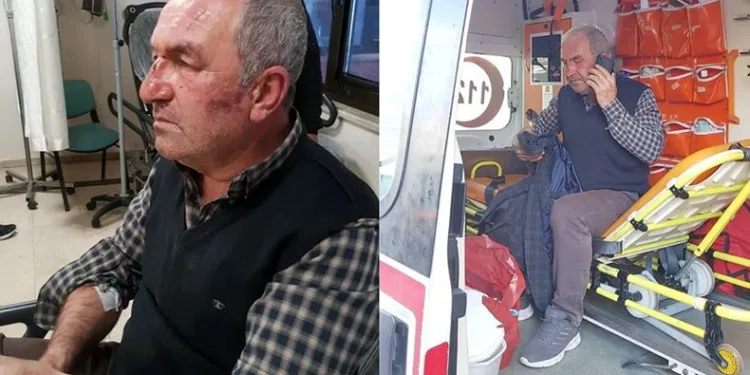 Kulak zarını patlatana kadar dövdüler