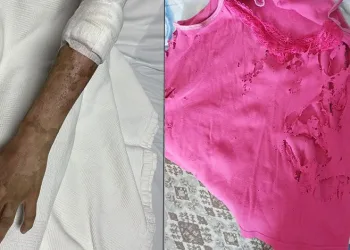 Lavabo açıcı bomba gibi patladı