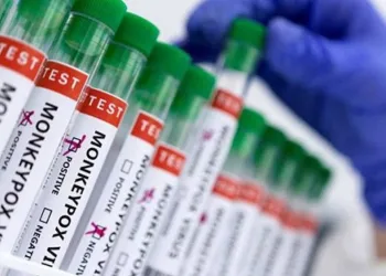 İlk yerel maymun çiçeği vakası