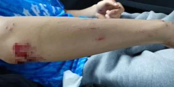 Sahipsiz köpekler hastanelik etti