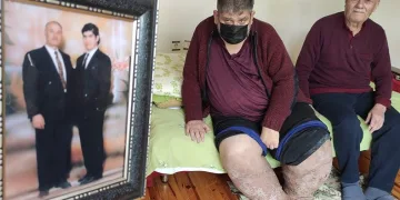 Sivrisinek ısırığı ile hayatı karardı