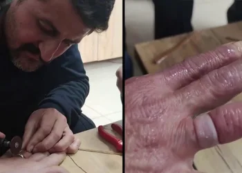 Yüzük parmağına sıkıştı, imdadına itfaiye koştu