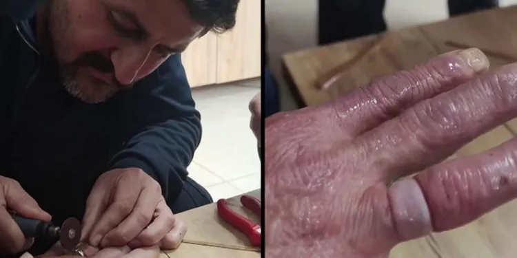 Yüzük parmağına sıkıştı, imdadına itfaiye koştu