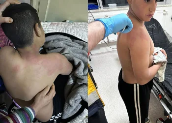 Seçim bürosunda çirkin olay.. çocuğa kaynar çay fırlatıldı