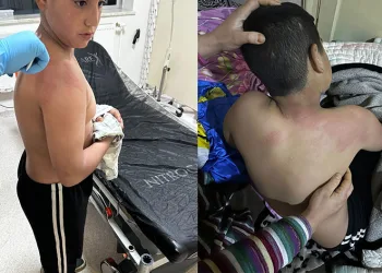 Seçim bürosuna gelen çocuğu kaynar çay fırlatan şahıs tutuklandı