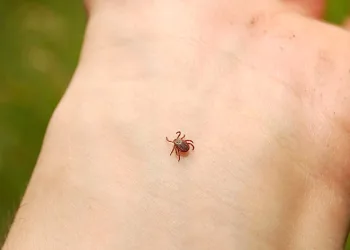 Havalar ısındı keneye dikkat