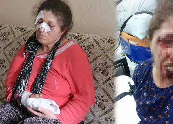 Kavgayı ayırmaya çalışırken darp edildi