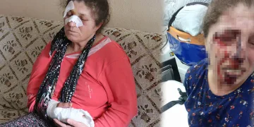Kavgayı ayırmaya çalışırken darp edildi