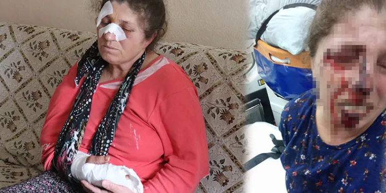 Kavgayı ayırmaya çalışırken darp edildi
