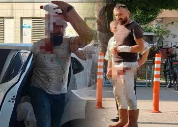 Bursa’da kendini kesen acemi kasap sayısı 462