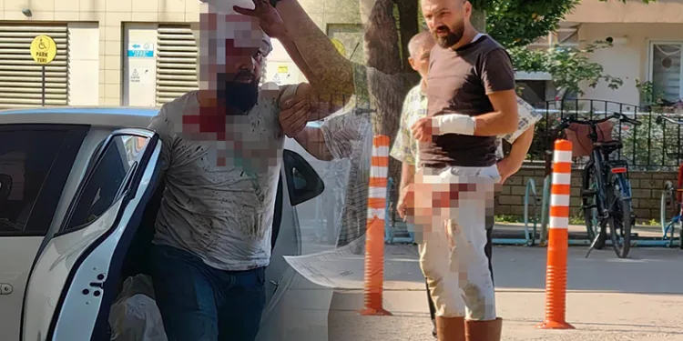Bursa’da kendini kesen acemi kasap sayısı 462